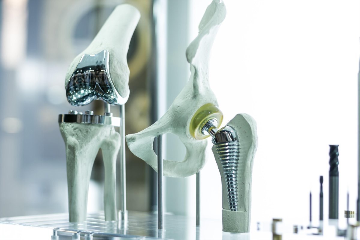 Foto Le protesi d'anca e ginocchio - Innovazioni nel rapido recupero dai primi passi alla piena funzionalità